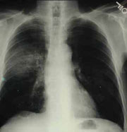 X-ray image (Copyright http://www.vesalius.com/)